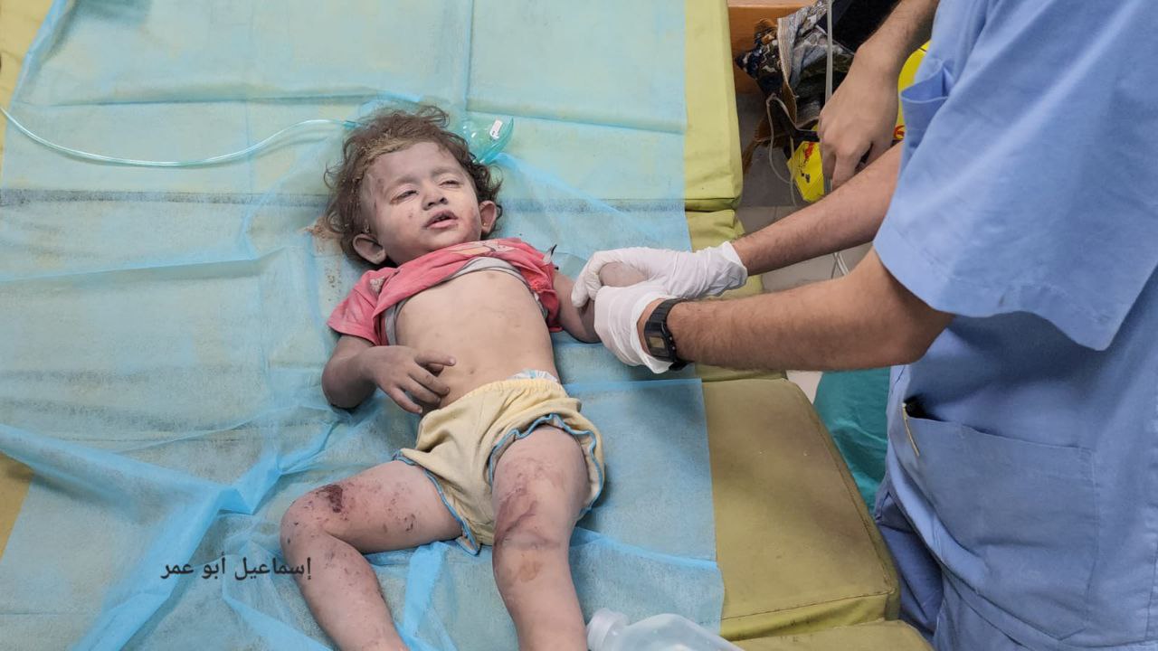 استشهاد أو إصابة ما يقرب من 8000 طفل في غزة منذ بدء العدوان