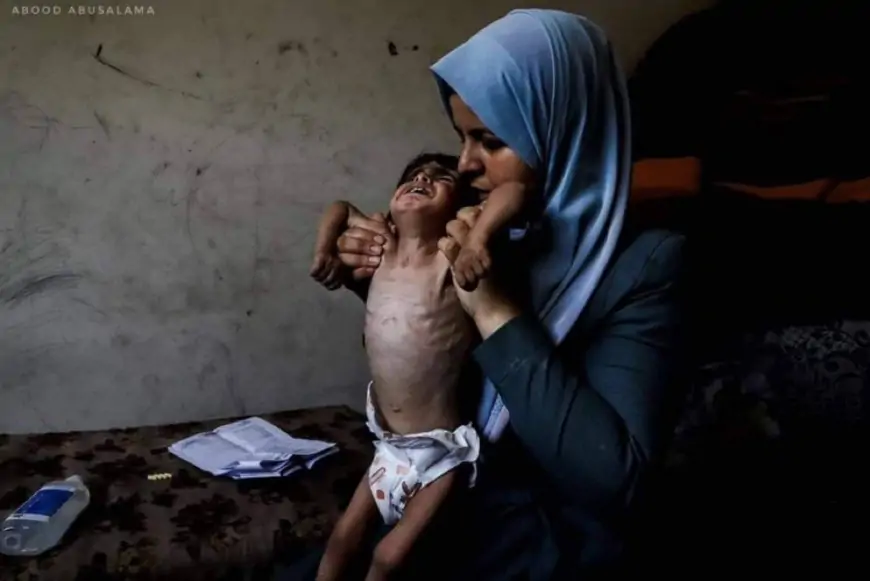 غزة .. تفشٍ واسع لسلالة جديدة من الإنفلونزا وسط نقص حاد بالأدوية بسبب الحصار والحرب